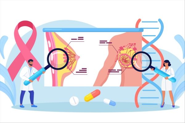 安科生物注射用曲妥珠单抗类似药在国内获批上市，治疗乳腺癌